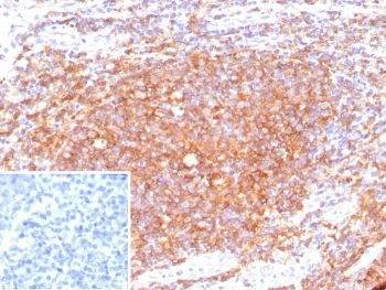 CD40 Antibody