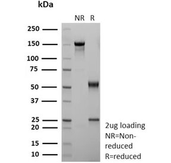 CD36 Antibody