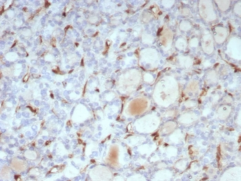 Thyroid Stimulating Hormone Receptor / TSHR Antibody (beta chain)