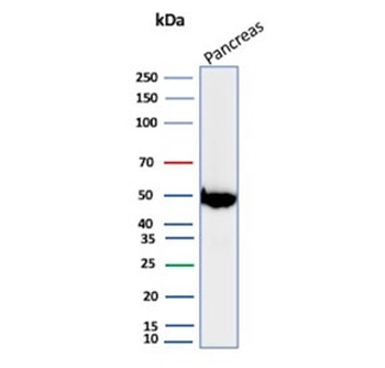 PNLIP Antibody / Pancreatic lipase