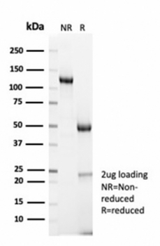 Cyclin B1 Antibody / CCNB1