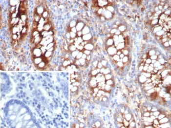 CEACAM1 Antibody / BGP-1