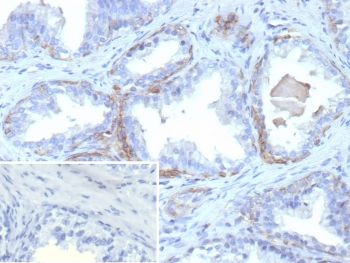 Cytokeratin 13 Antibody / KRT13