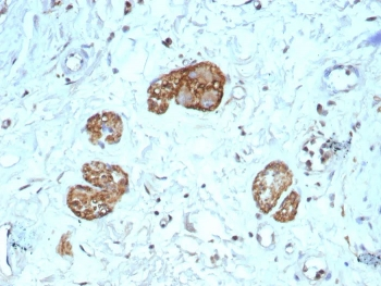 NCAM / CD56 Antibody
