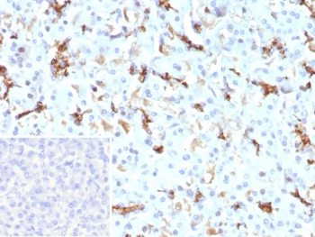 CFTR Antibody / Cystic Fibrosis Transmembrane Regulator