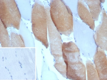 MYH7 Antibody / Myosin 7