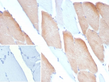 MYH7 Antibody / Myosin 7