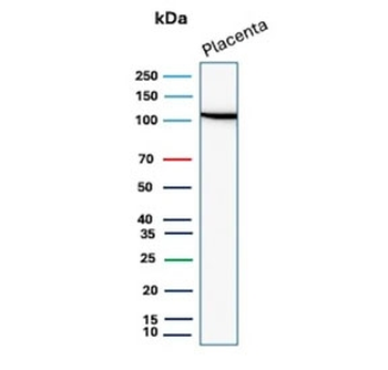 E-Cadherin Antibody / CDH1