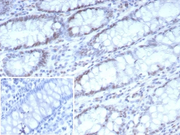 CDK4 Antibody