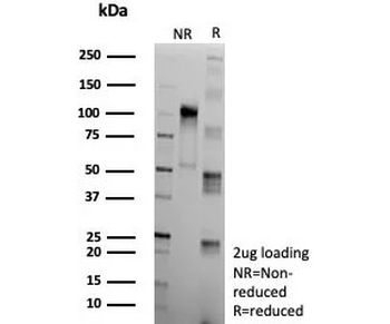 Clusterin Antibody / Apolipoprotein J / APO-J