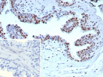 AR-V7 Antibody / Androgen Receptor