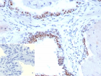 Androgen Receptor V7 Antibody