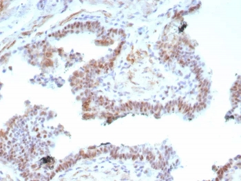 AR-V7 Antibody / Androgen Receptor