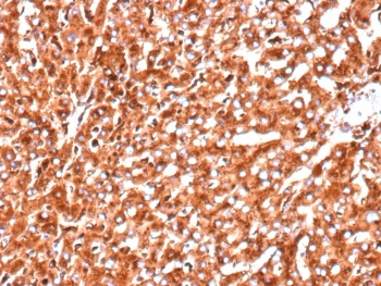 CTSD Antibody / Cathepsin D