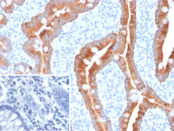 Cytokeratin 8/18 Antibody