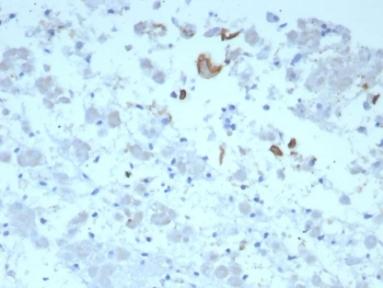 IL-6 Antibody