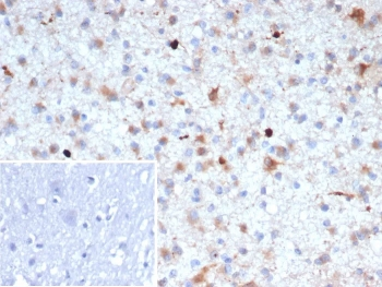 Amyloid beta Antibody / APP