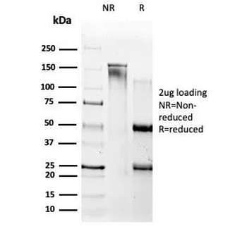 Amyloid beta Antibody / APP