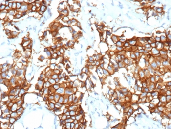 HER2 Antibody / ErbB2