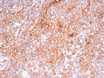 Pan-HLA Antibody MHC II (DP/DQ/DR)