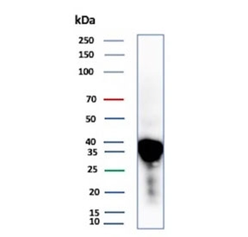 Apolipoprotein E Antibody / APOE
