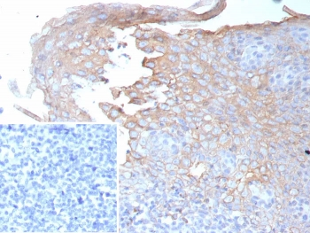 Interferon gamma Antibody