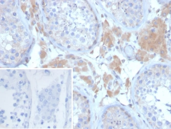 GDF9 Antibody / Growth Differentiation Factor 9