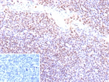 EBV Antibody / Epstein-Barr Virus