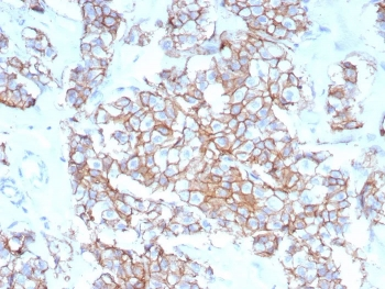 HER2 Antibody / ErbB2