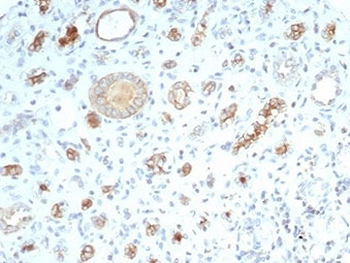 CFTR Antibody / Cystic Fibrosis Transmembrane Regulator