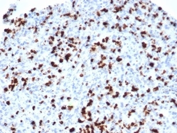 TIA-1 Antibody / T-Cell Intracellular Antigen-1