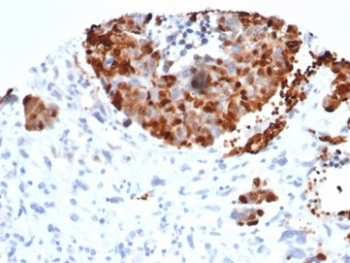 INSM1 Antibody