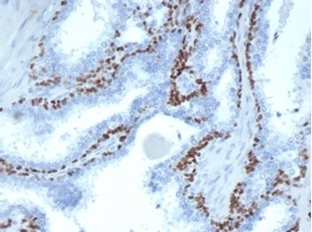 p63 Antibody / Tumor protein 63
