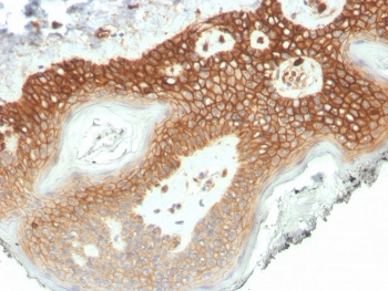 p120 Catenin Antibody / CTNND1 / Catenin delta 1