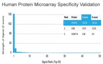 PDGF beta Antibody