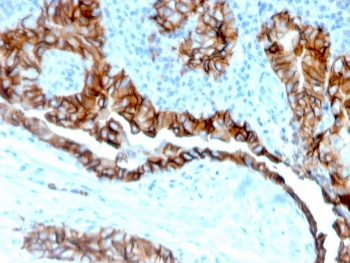 TROP2 Antibody / TACSTD2