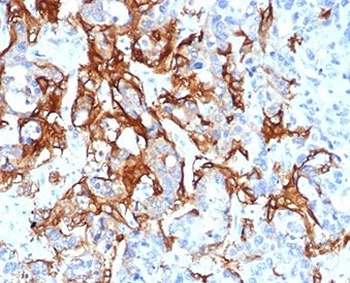 TROP2 Antibody / TACSTD2