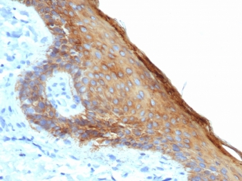 Basic Cytokeratin Antibody (HMW / Type II)
