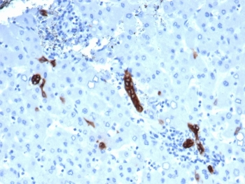 TROP2 Antibody / TACSTD2