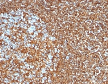 Vimentin Antibody