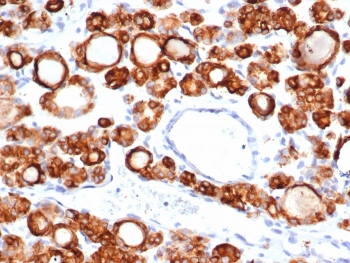 Thyroid Peroxidase Antibody
