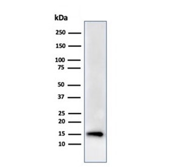 FABP5 Antibody