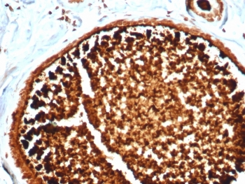 Mammaglobin A Antibody / SCGB2A2