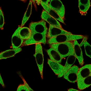 MSK1 Antibody / RPS6KA5