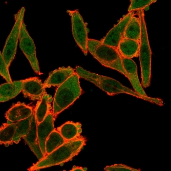 TSC22D1 Antibody / TSC22