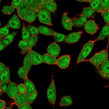 Ubiquitin-conjugating enzyme E2 B Antibody / UBE2B