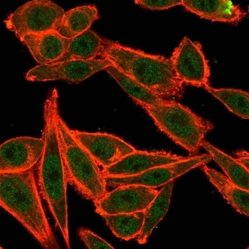 TARBP2 Antibody