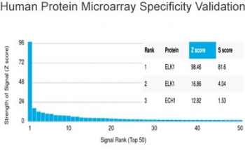 ELK1 Antibody