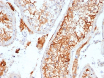 INHA Antibody / Inhibin alpha