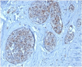 MDM2 Antibody